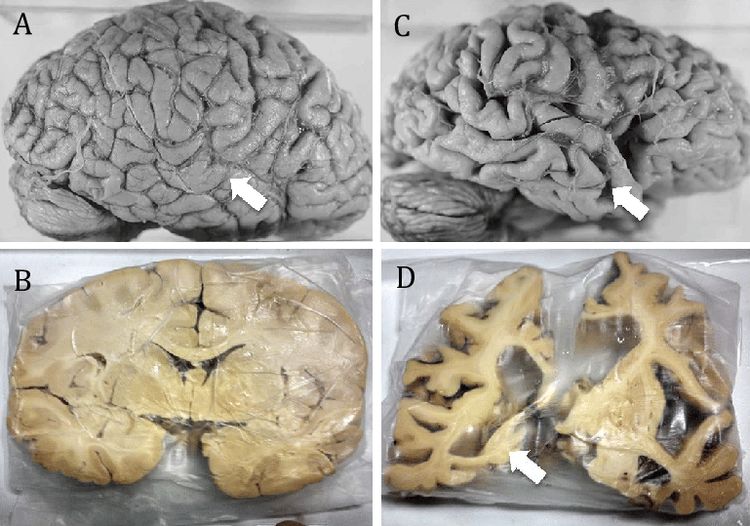 image-20221114150159-2