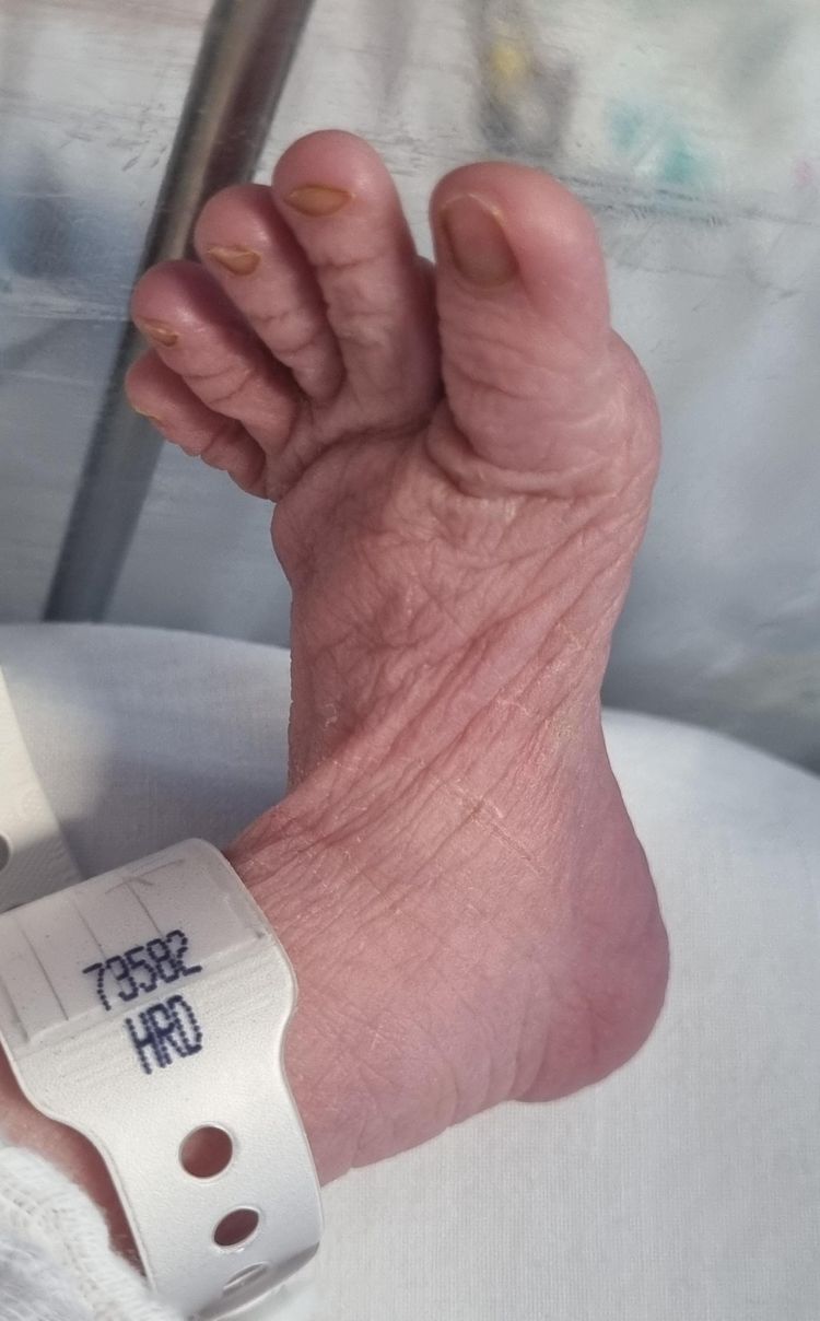 image-20221116172650-15