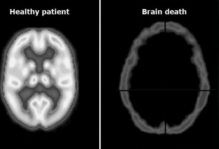 image-20221214211347-11