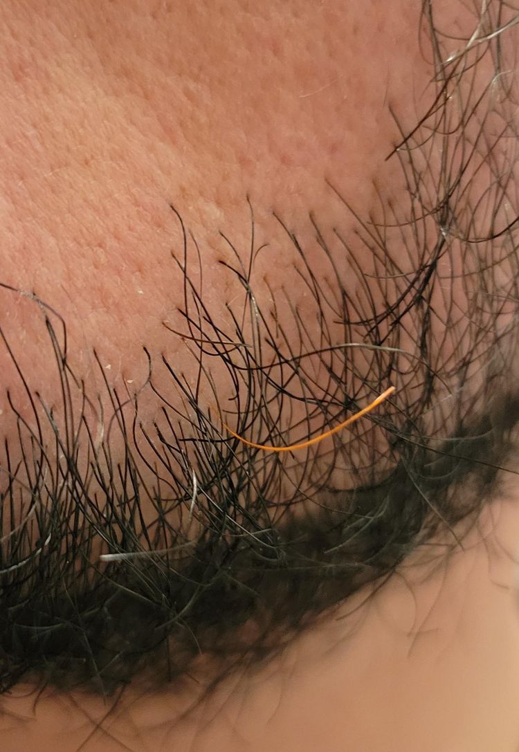 image-20230207155455-15