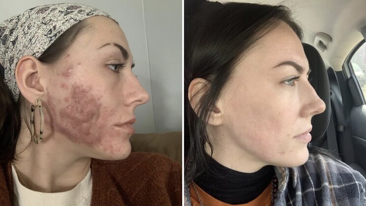 image-20230209132712-3