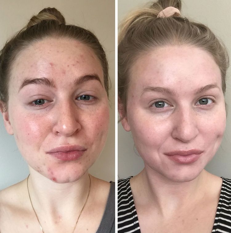 image-20230209133758-21