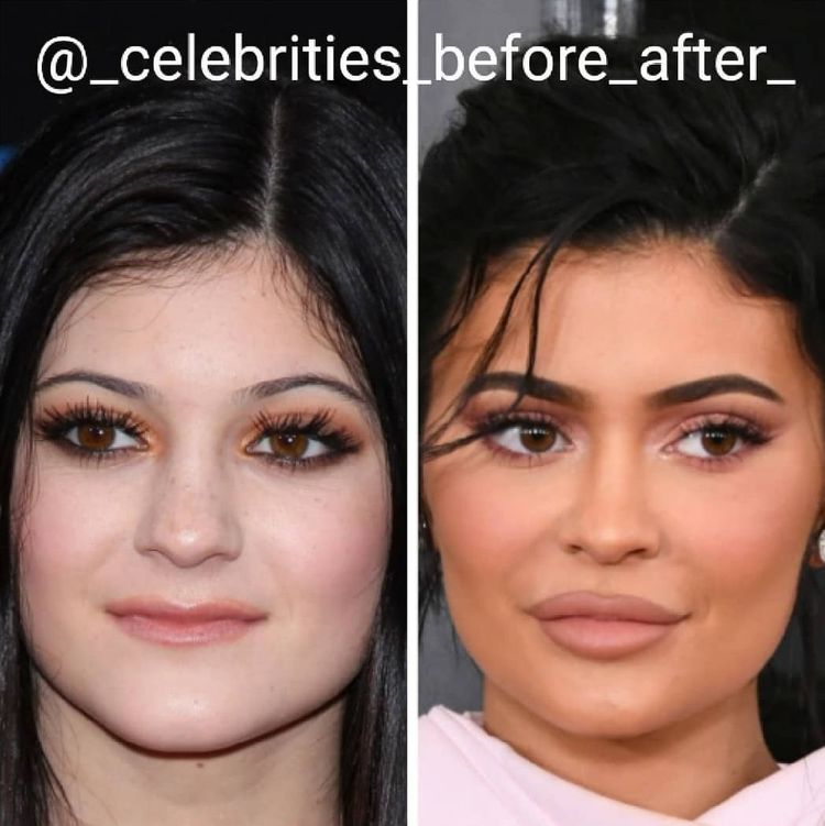 image-20230209164432-13