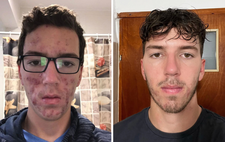 image-20230217134134-15