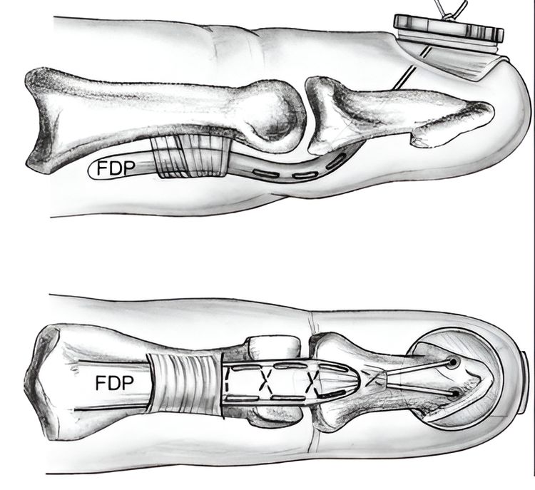 image-20230522140538-1