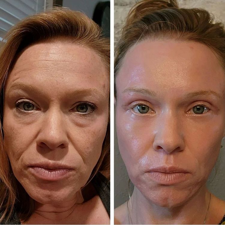 image-20230811154424-14