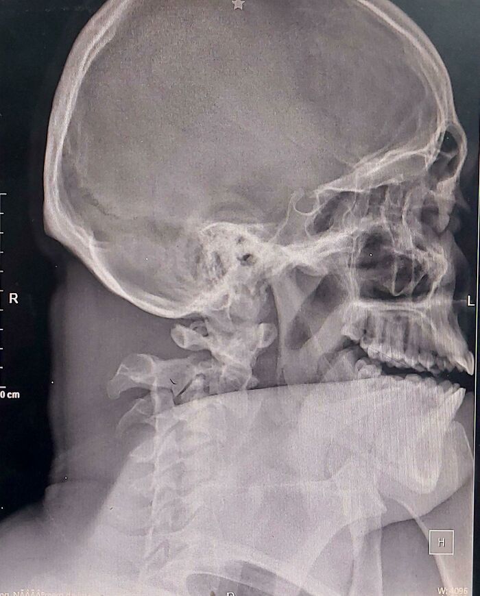 image-20230823162425-7