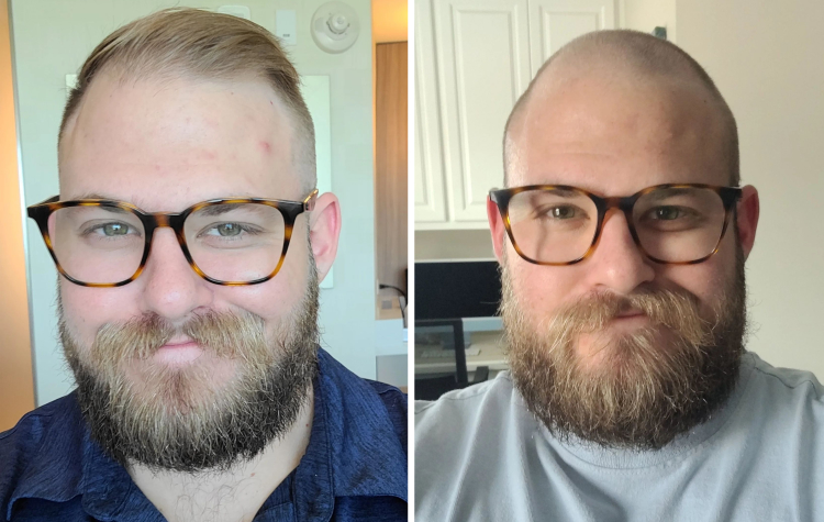 image-20231108133604-13