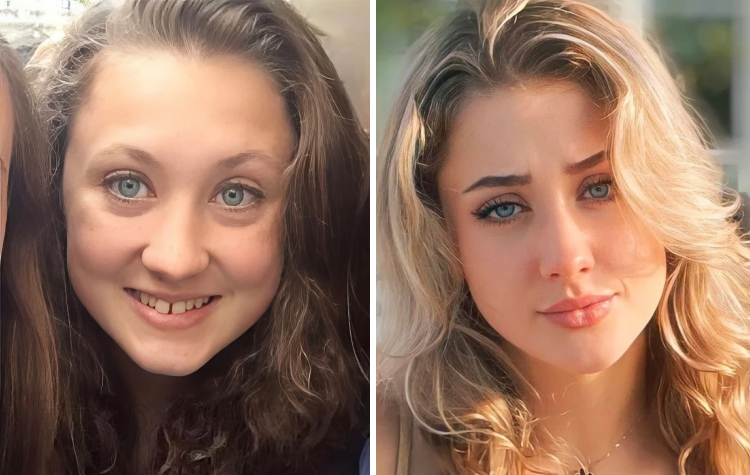 image-20231126141137-15