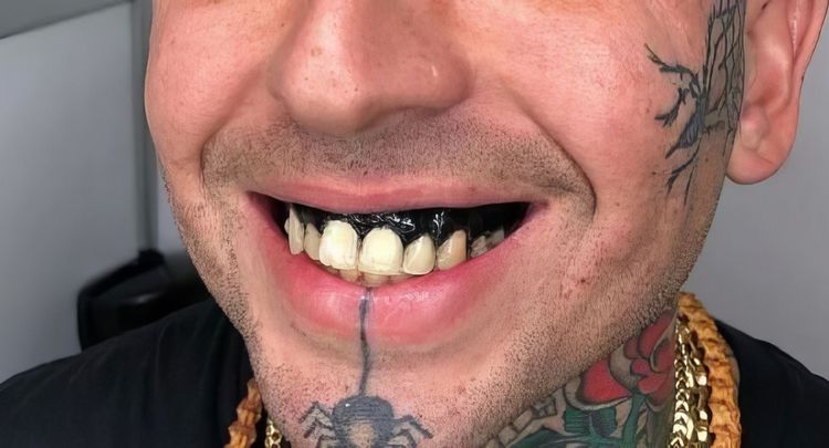 image-20240126160227-19