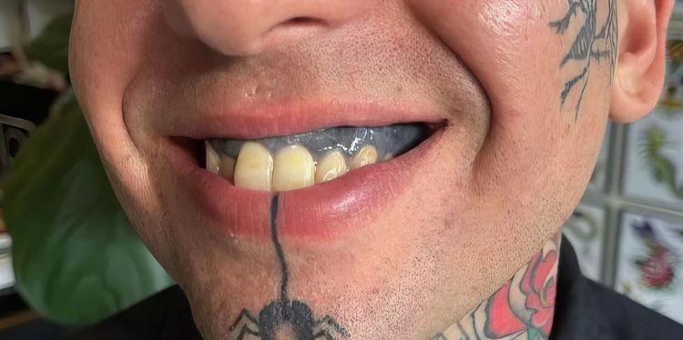 image-20240126160231-20