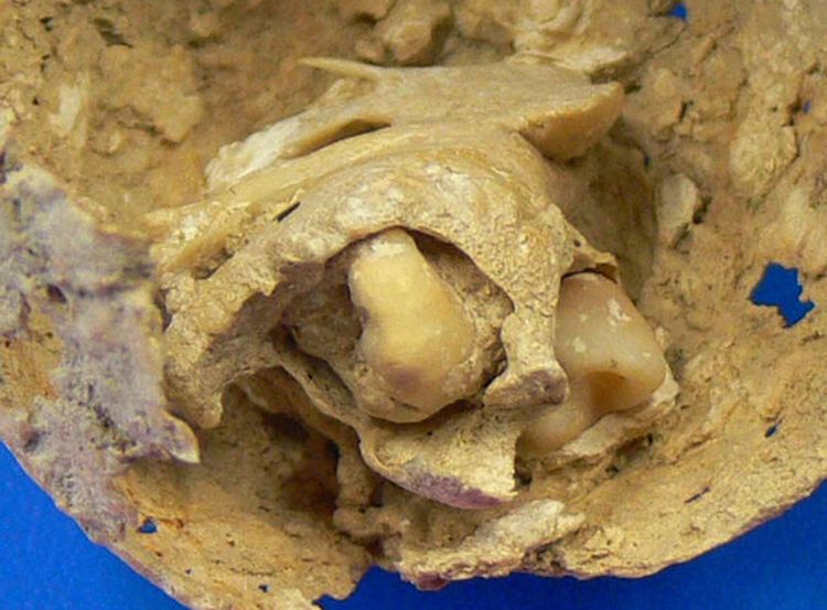 image-20240212154605-12