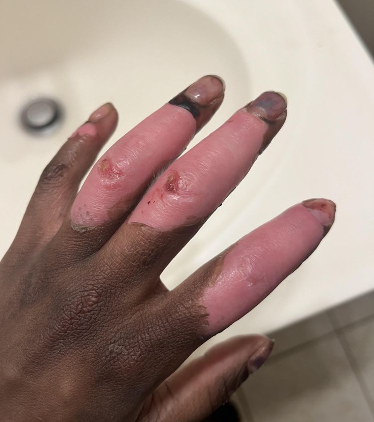 image-20240214141246-6