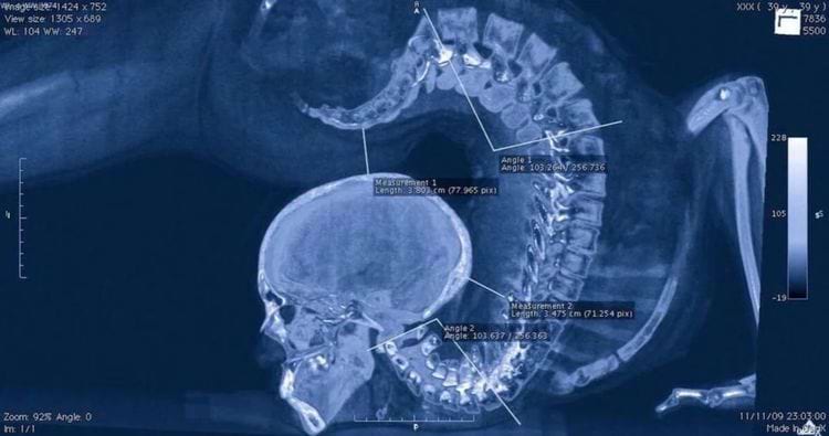 image-20240228154755-5