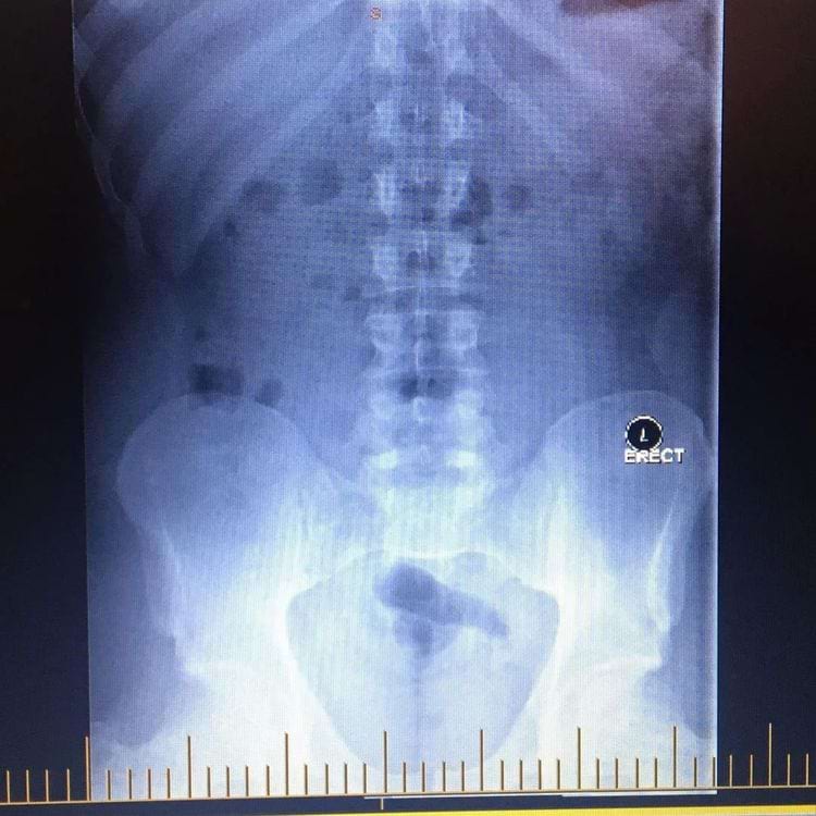 image-20240228154817-10