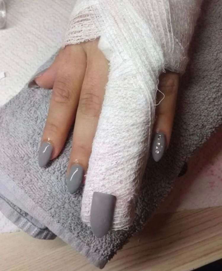 image-20240313142522-16