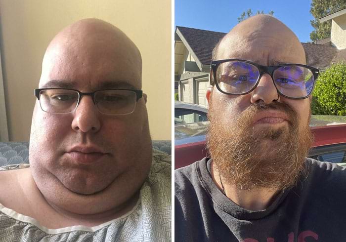 image-20240402162826-17