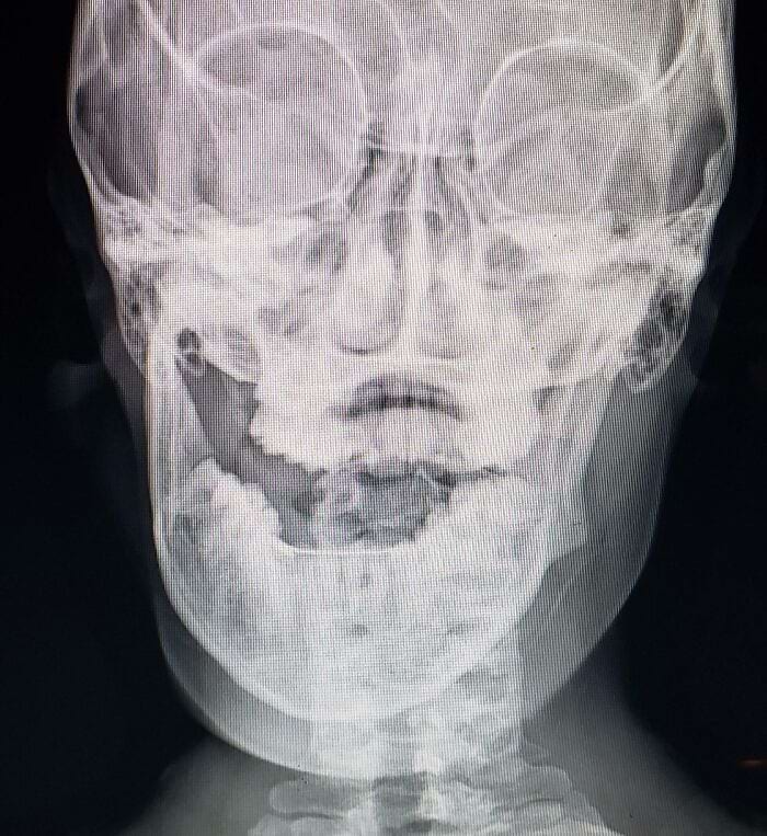 image-20240531111006-7