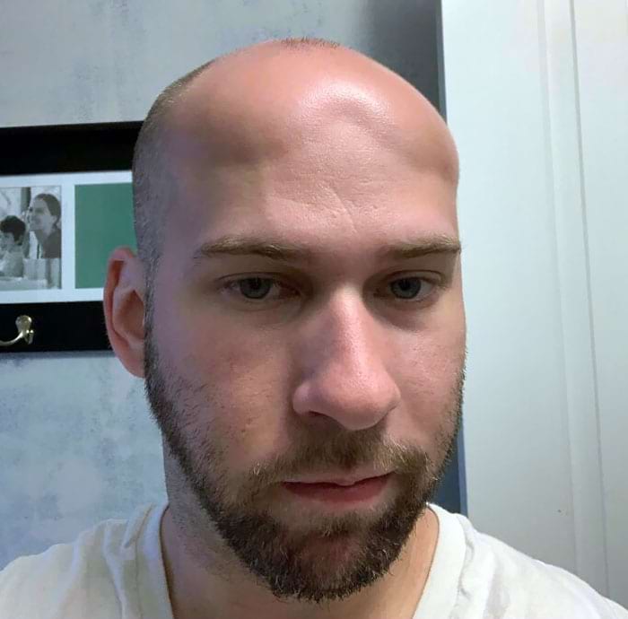 image-20240722164649-6