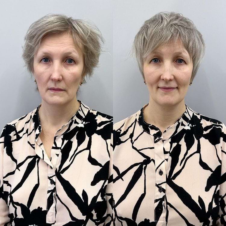 image-20240801114054-7