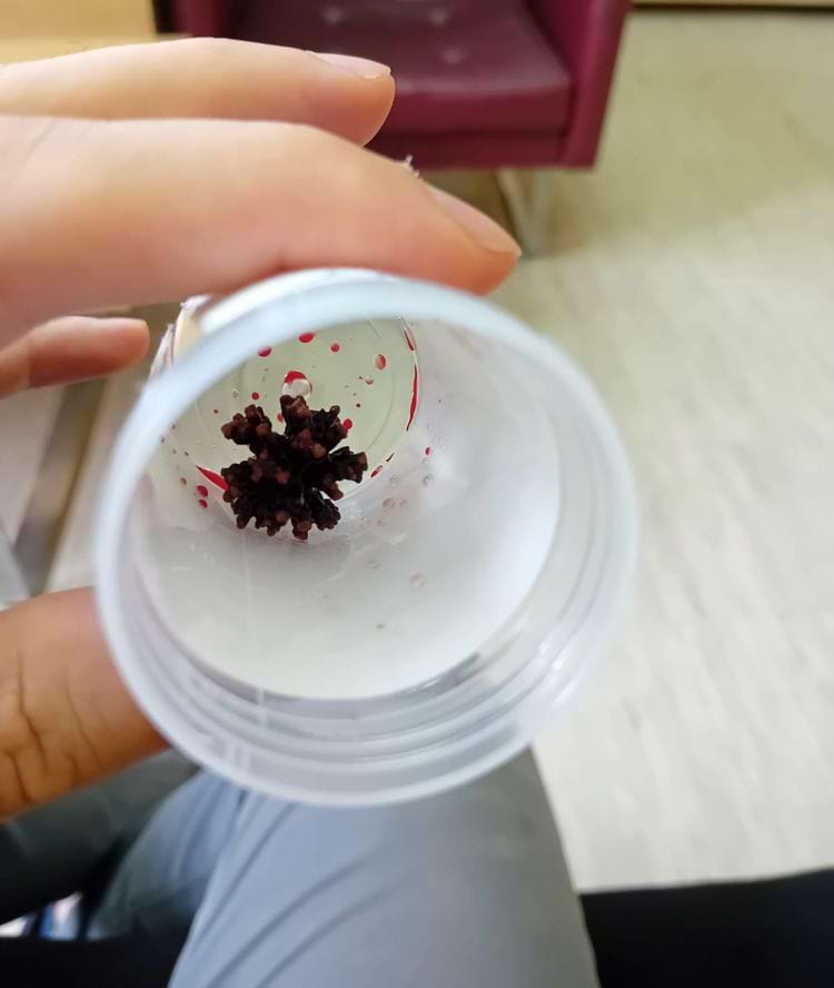 image-20240821151623-2