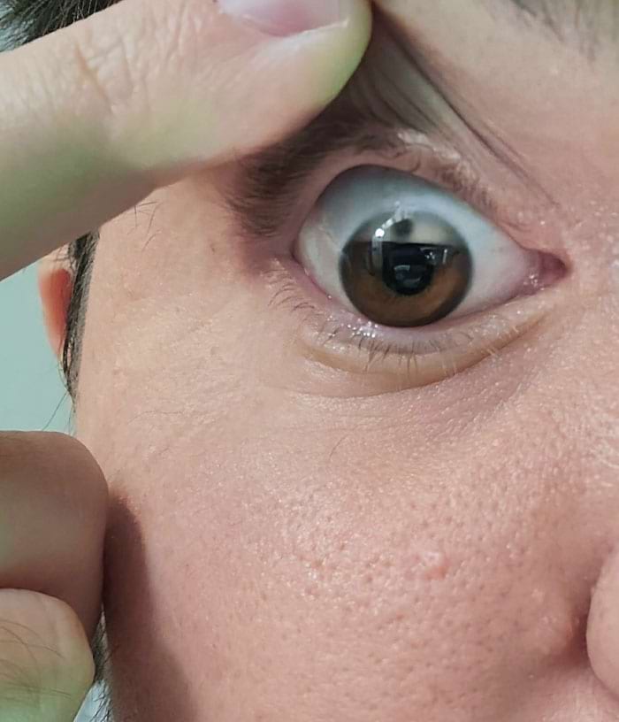 image-20241112135251-15