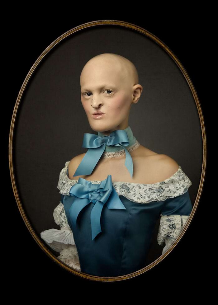 image-20250313141635-9