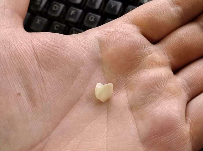 image-20250327172326-6