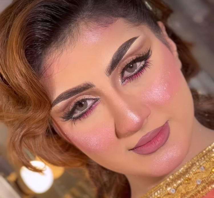 image-20250403143718-14