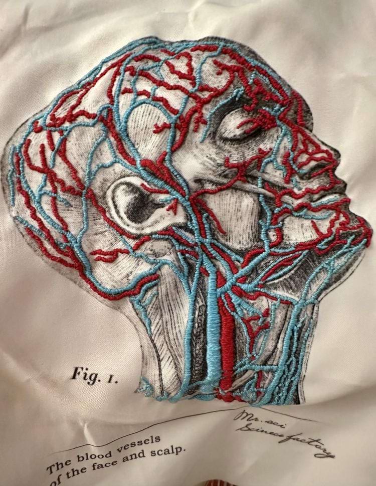 image-20250408154220-17