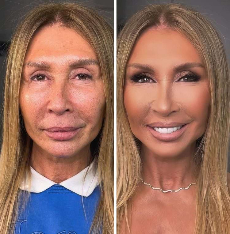 image-20250423114429-9