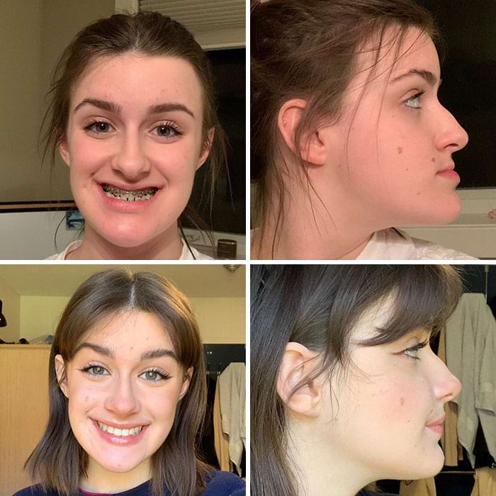 image-20250512165725-1