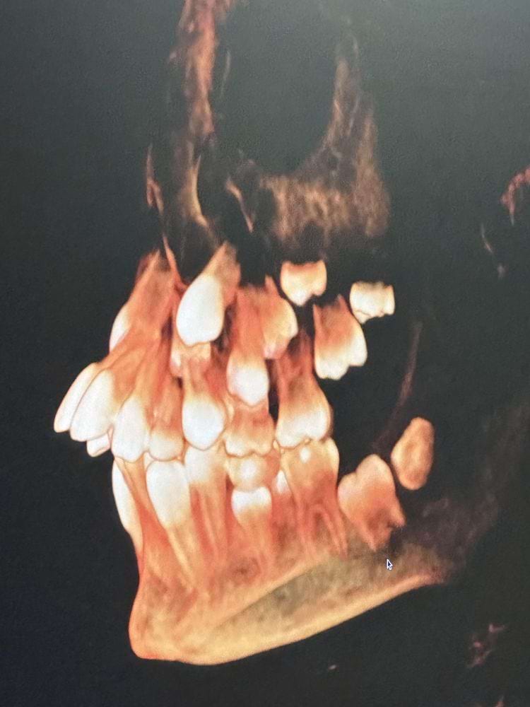 image-20250515150502-5