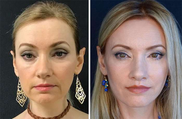 image-20250707103045-16