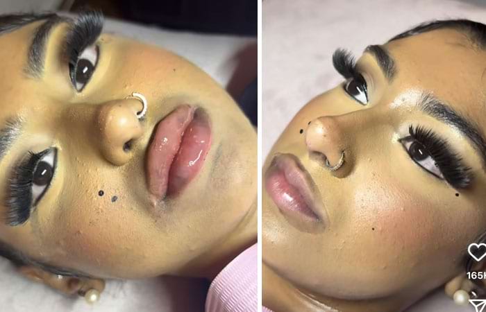 image-20250714171812-18