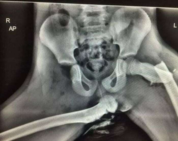 image-20250731122852-8