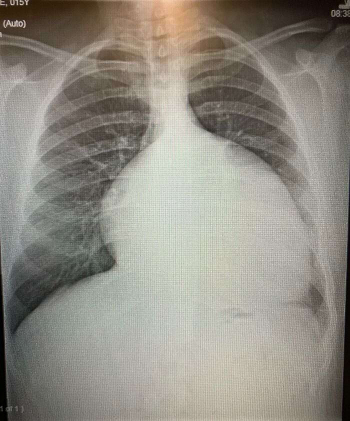 image-20250731122904-12