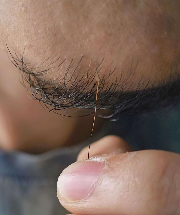  волос на лице рыжий у основания