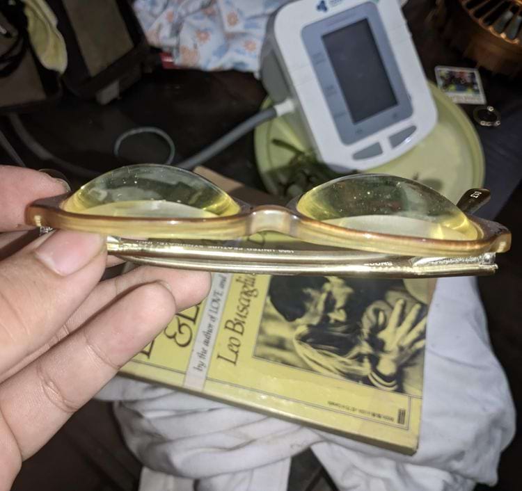 Толщина очков мужчины, у которого была диагностирована аниридия