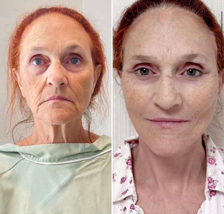 image-20250808111134-2