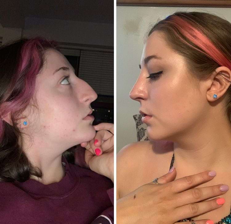 image-20250808111143-5