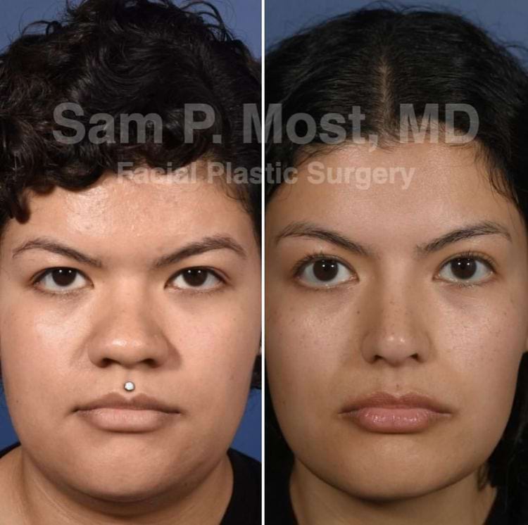 image-20250808111148-7