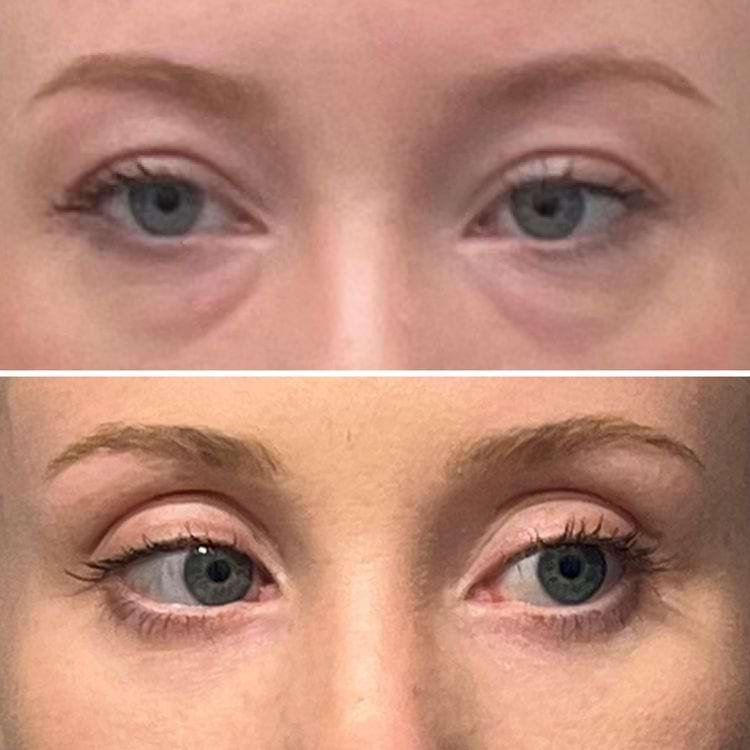 image-20250808111151-8