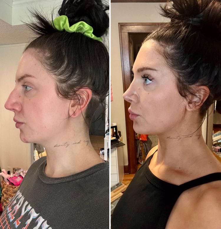 image-20250808111155-9