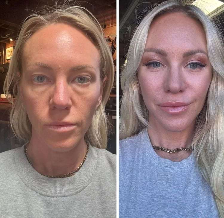 image-20250808111158-10