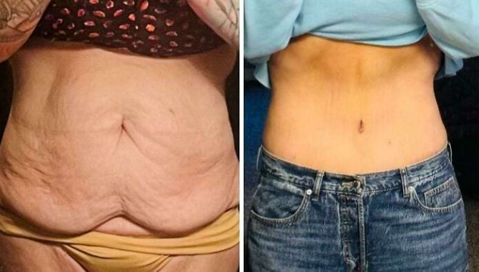 image-20250808111213-15