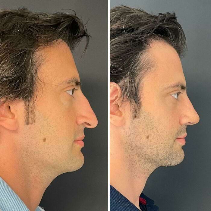 image-20250808111221-18