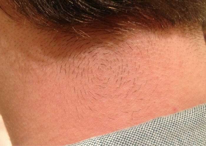 image-20250903143948-1