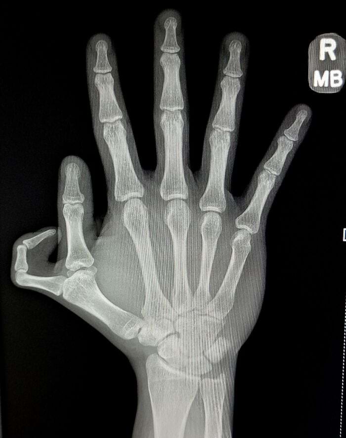 image-20250903143953-3