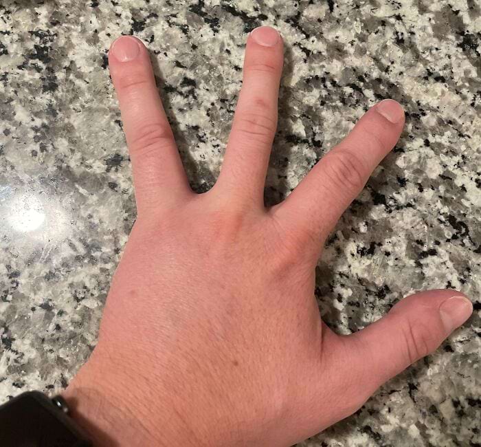 image-20250903144013-9